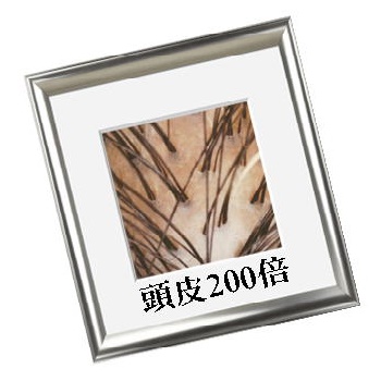 頭皮拡大写真
