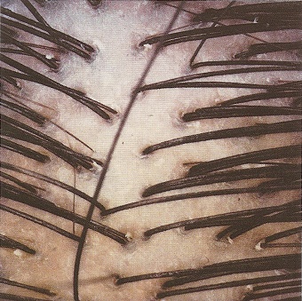 scalp1