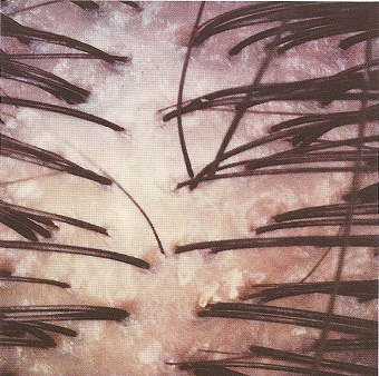 scalp2